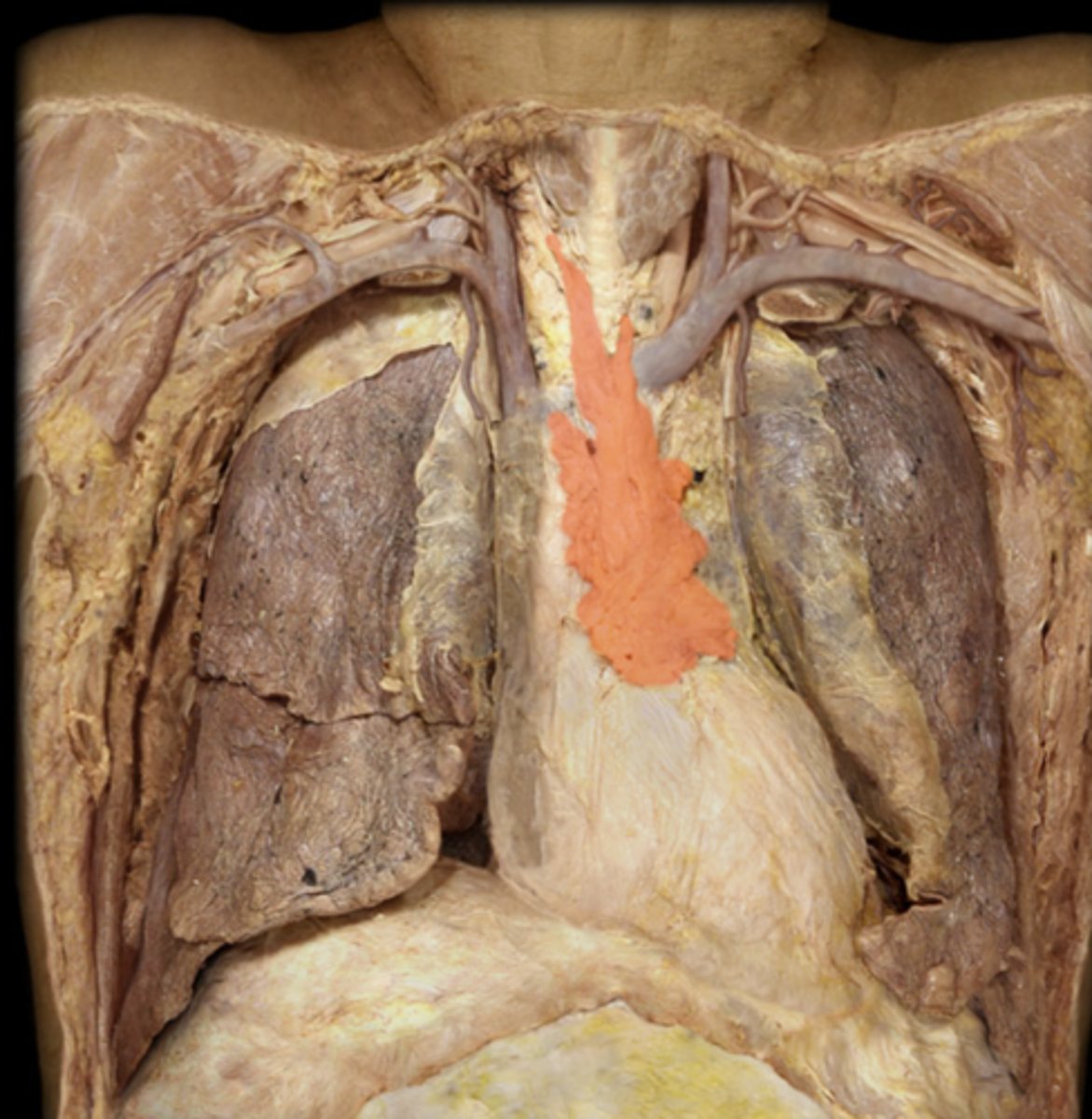 <p>What lymphatic structure is highlighted in this image?</p>