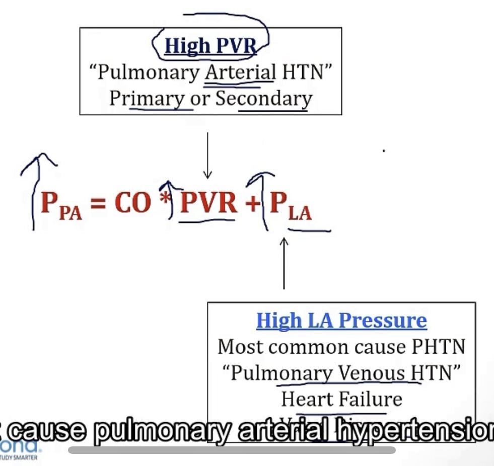 <p>-P2, second heart sound; left upper sternal border</p><p>-arteriosclerosis; thickened smooth muscle walls and narrowed lumen</p><p>-cor pulmonale</p><p>-right heart catheterization; echocardiography</p><p>-left atrium; pulmonary veins; pulmonary venous HTN; heart failure; valve disease</p><p>-pulmonary arterial HTN</p>