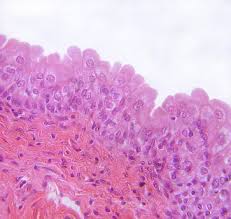 <p>A type of epithelium consisting of multiple layers of cells that can stretch, found primarily in the urinary bladder, ureters, and part of the urethra, allowing for flexibility and expansion. basal cell layers are cuboidal&nbsp;and the upper layers are flattened or dome-shaped. </p>