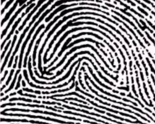 <ul><li><p>2 or more deltas and a combination of other 2 patterns</p></li></ul><ul><li><p>The other patterns cannot be a plain arch </p></li></ul><p></p>