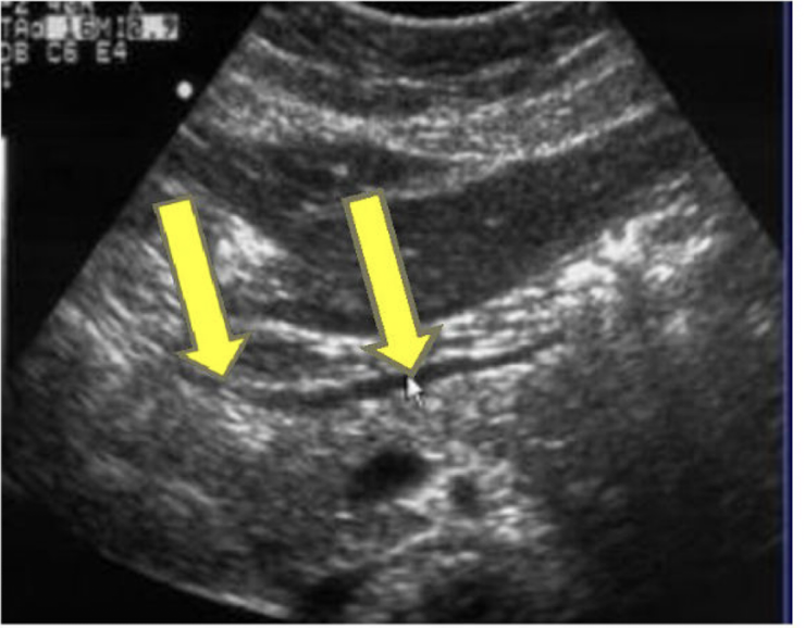 <p>What are the yellow arrows pointing to?</p>