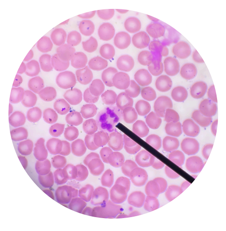 <p>what kind of white blood cells is this?</p>