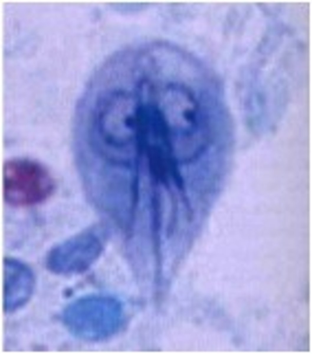 <p>Infective- human ingests cyst</p><p>Diagnostic- trophozoites are passed in stool or look for a cyst</p>