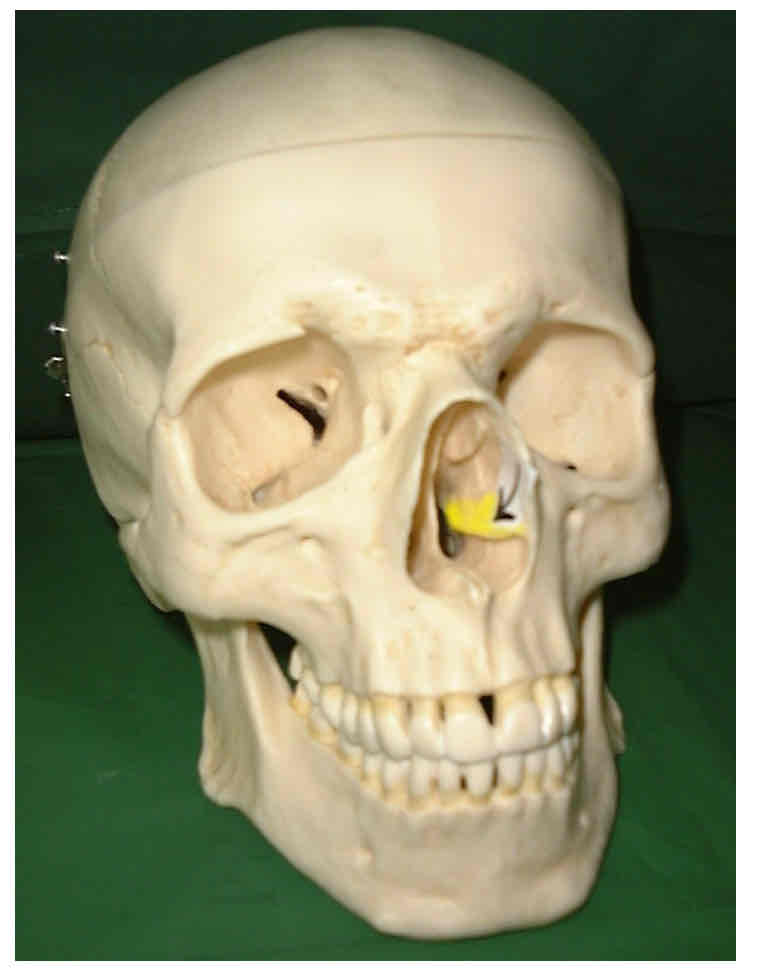 term image