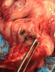 <p>Describe this pathology</p>