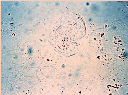 <p>These cells are present on sediment evaluation. What are they?</p>