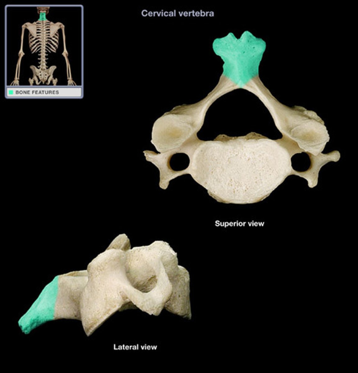 <p>name this part of the cervical vertebrae</p>