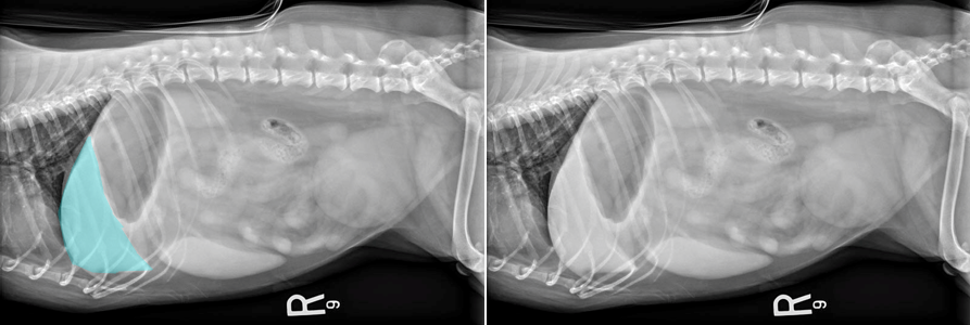 <p>What structure is highlighted in blue in the left image below?</p>