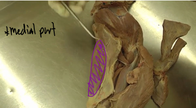 <p><span>Brachial Region (Arm)</span></p>