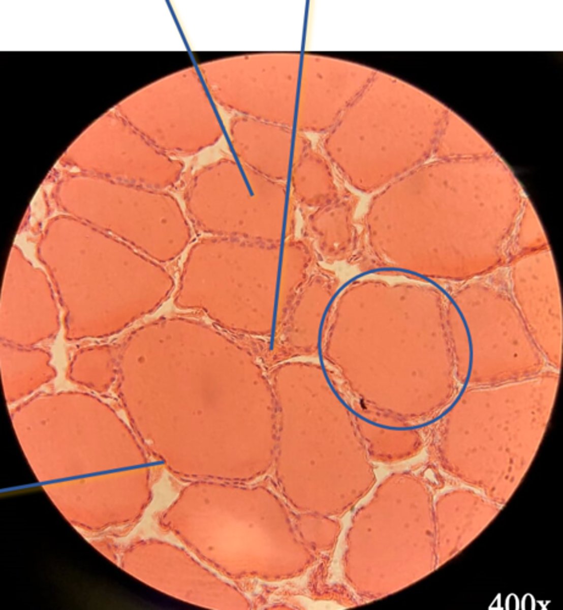 <p>What is circled?</p>