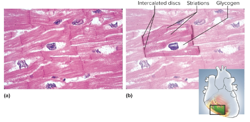 <p>Cardiac muscle</p>