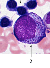 <p>IDENTIFY THE CELL</p><p>NOTE: NO BLUSH OR PINKISH GRANULES, JUST DARK PURPLE</p><p>NOTE AT THE SIZE</p>