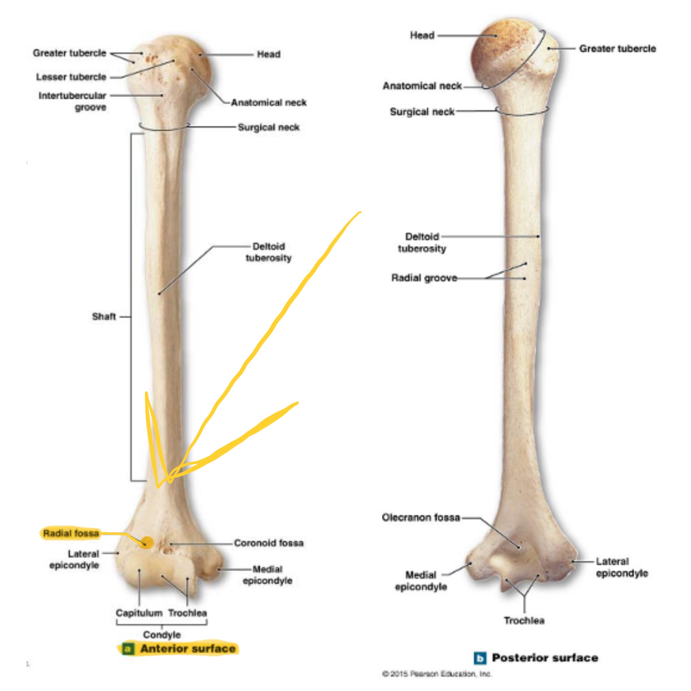 <p>small depression above capitulum on anterior surface; receives head of radius when elbow is flexed</p>
