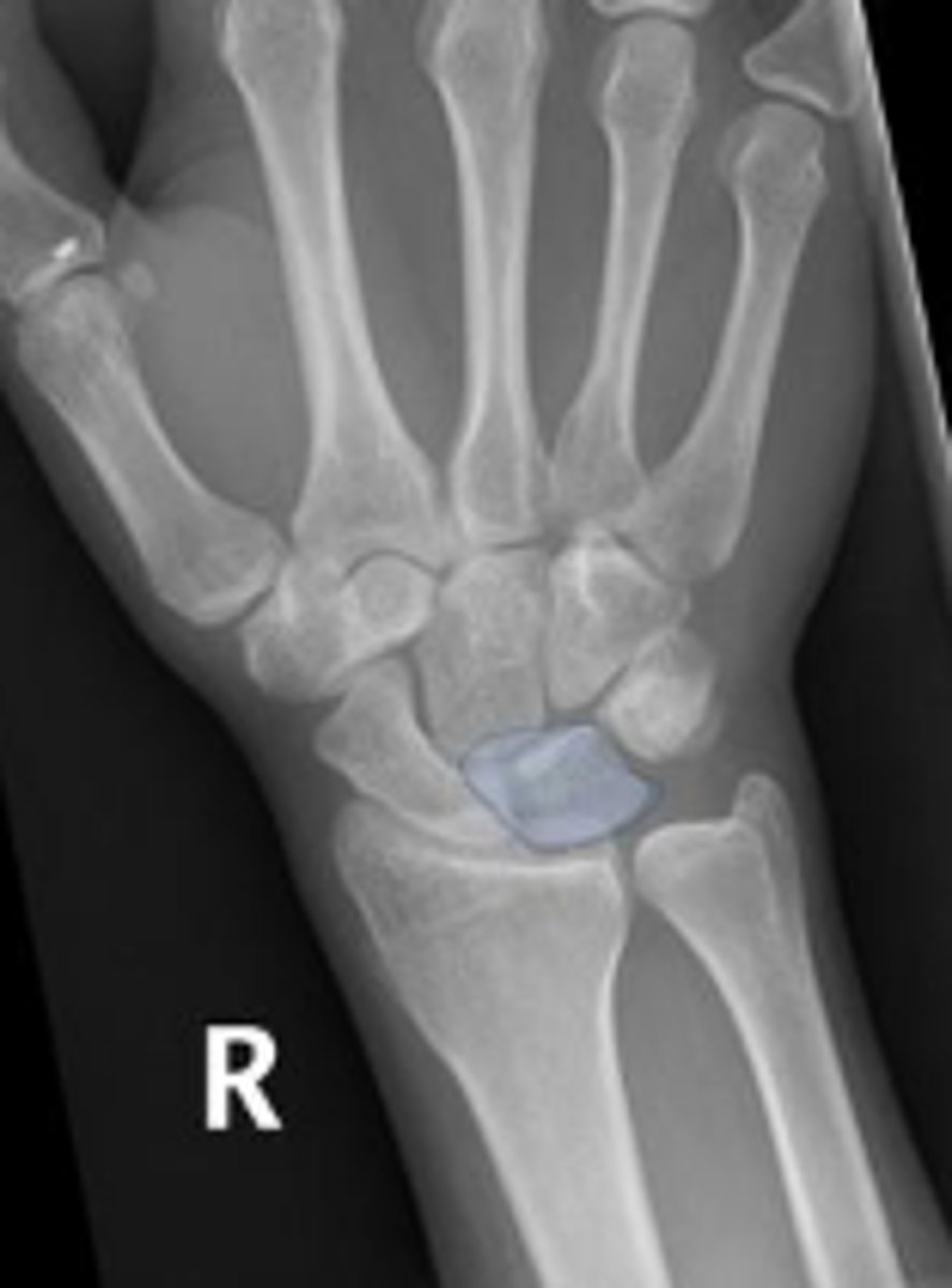 <p>What is outlined?</p>