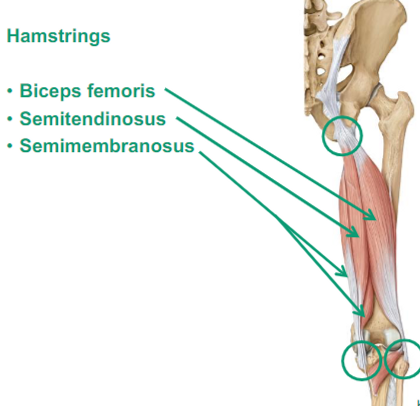 <p>Describe Semitendinosus thigh muscle</p>