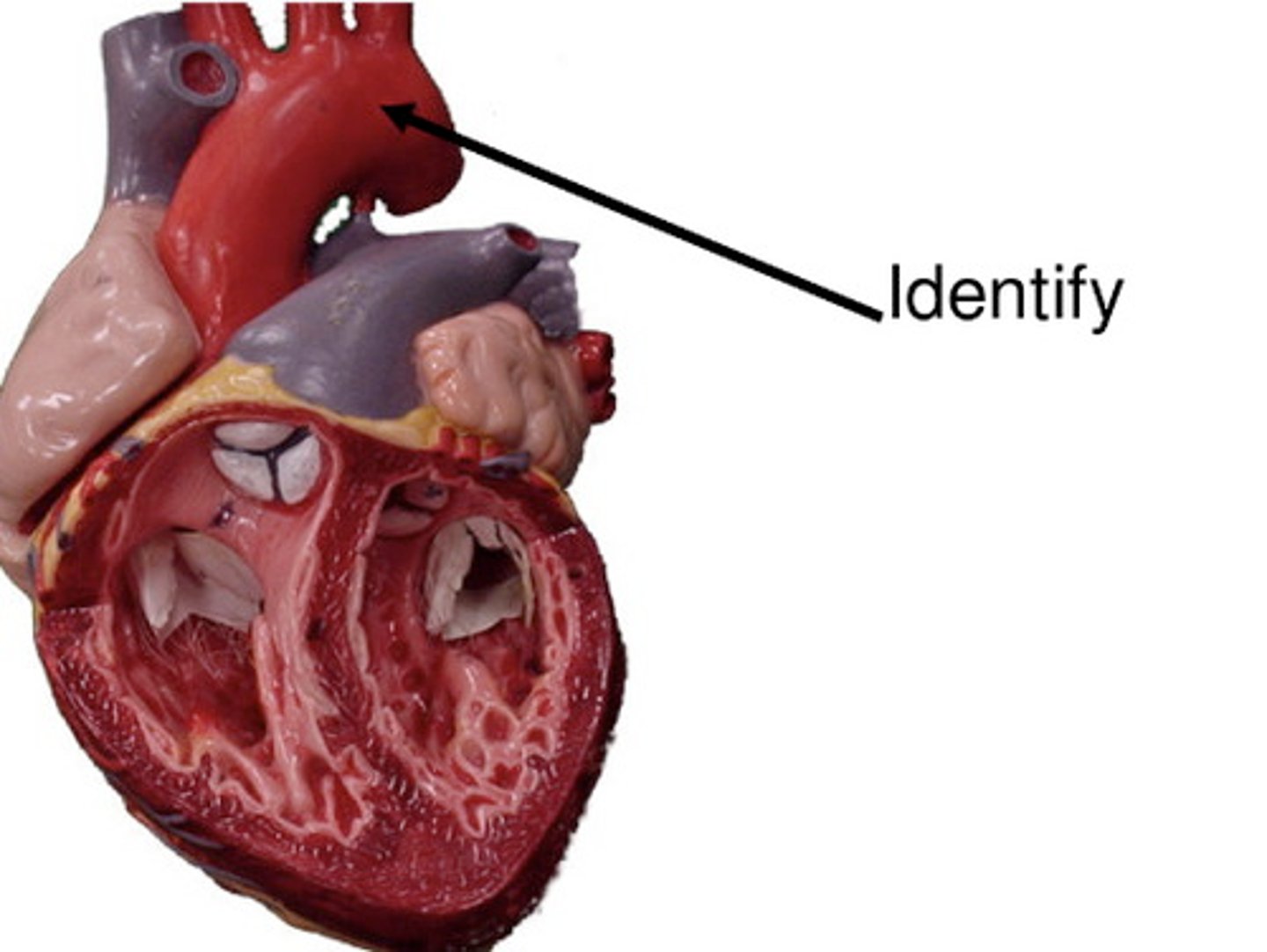 <p>Aortic Arch</p>