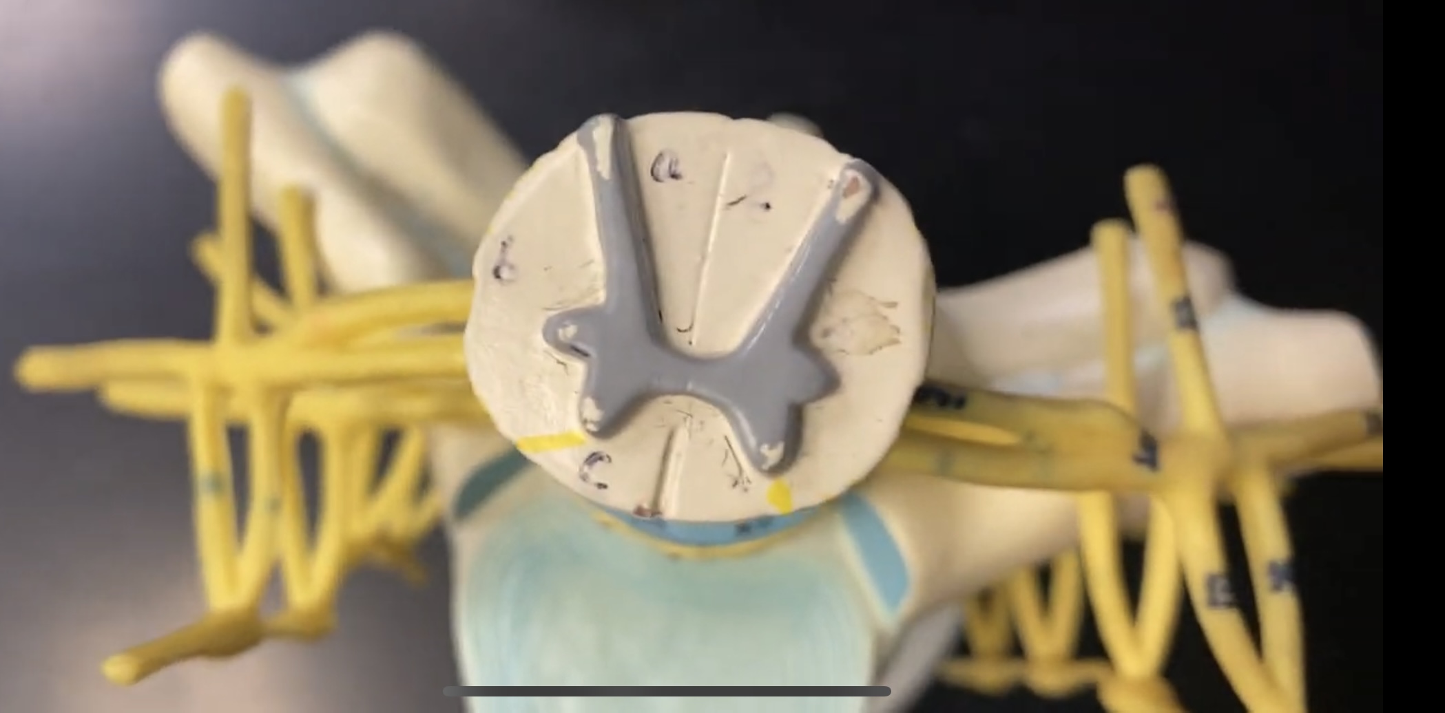 <p>posterior (dorsal) horn; R—&gt;L</p>