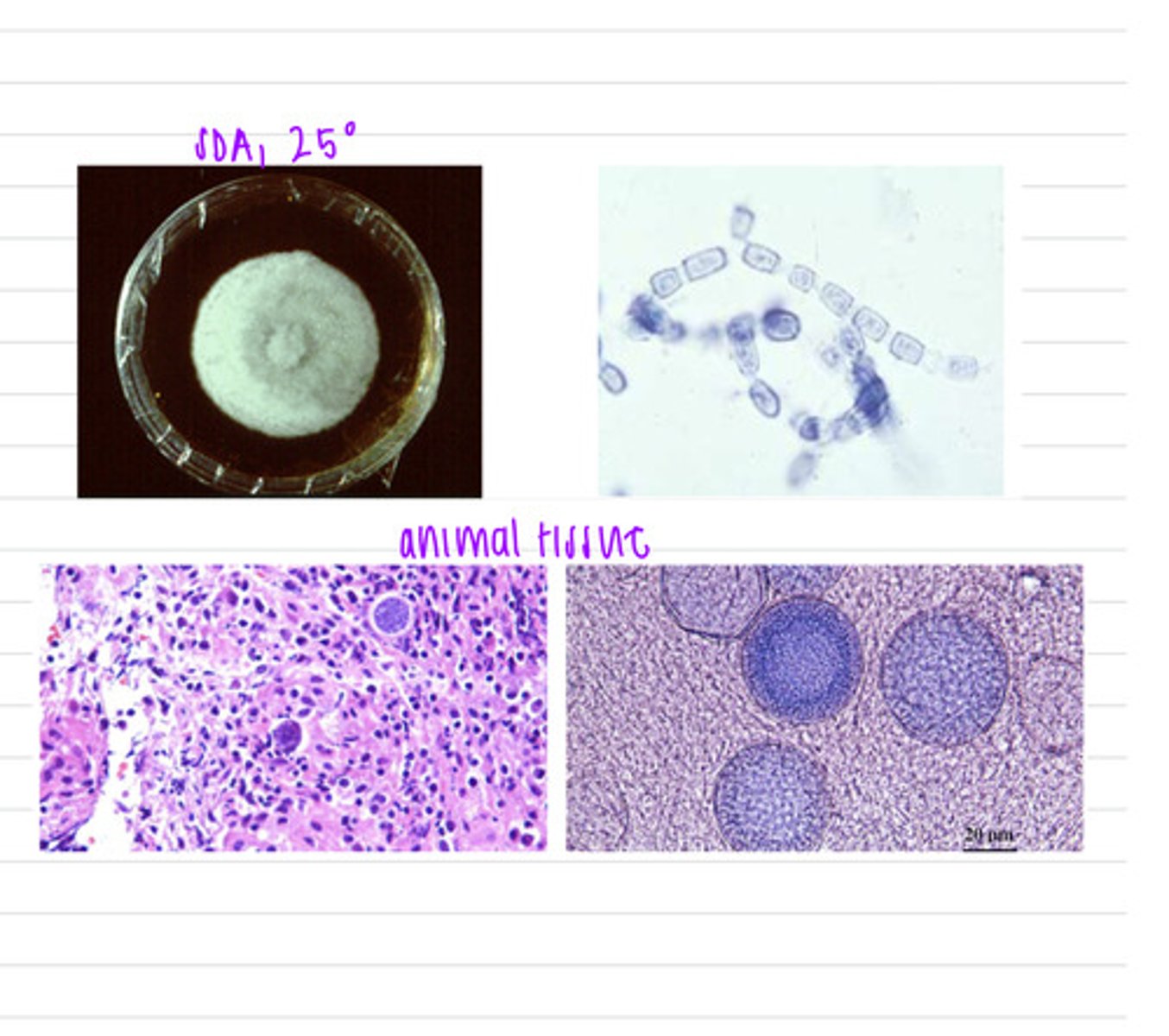 <p>a horse's owner calls the vet because it is coughing, has a fever, has lost weight, and seems weak. we take samples and isolate them both on BHI at 37 degrees and SDA at 25 degrees.</p><p>what is the diagnosis?</p>