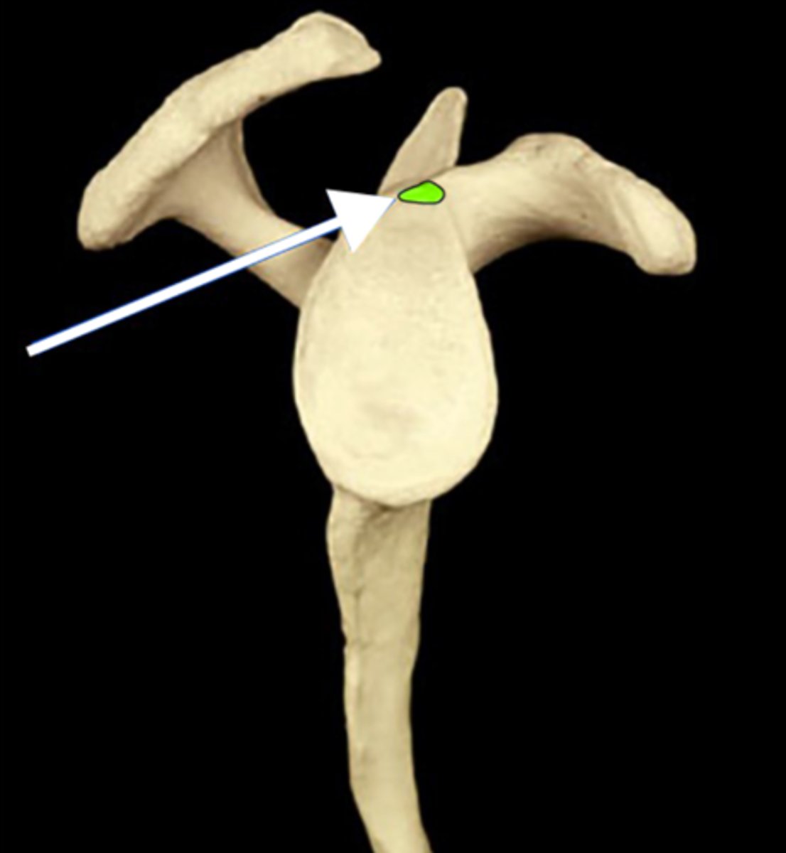 <p>prominence superior to the glenoid cavity</p>