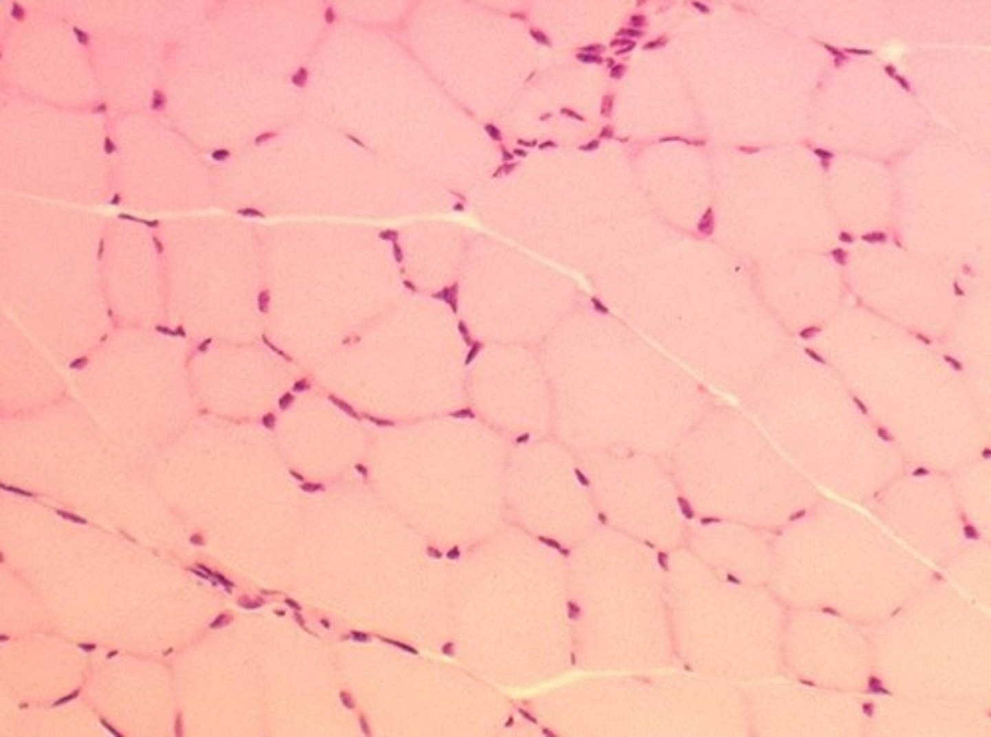 <p>Muscle type with visible striations.</p>