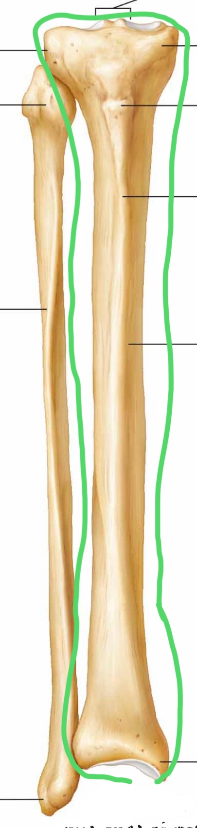 <p>What bone is circled?</p>