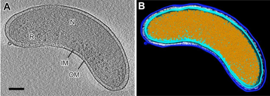 <p>Shown in the figure is the Pelagibacter, enumerate its following characteristics</p>