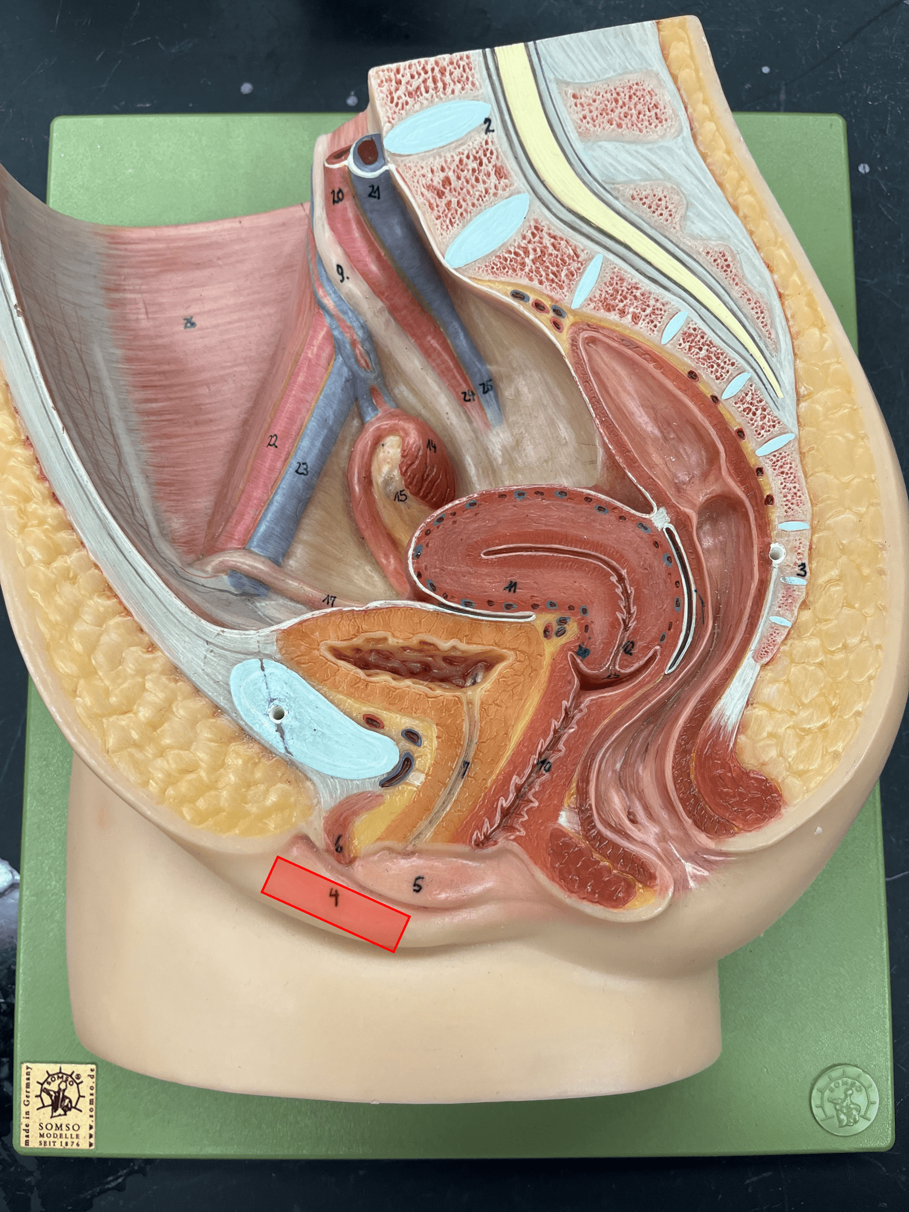 • External female genitalia.

• A fold of skin lateral to the labia minora and may be covered in hair.