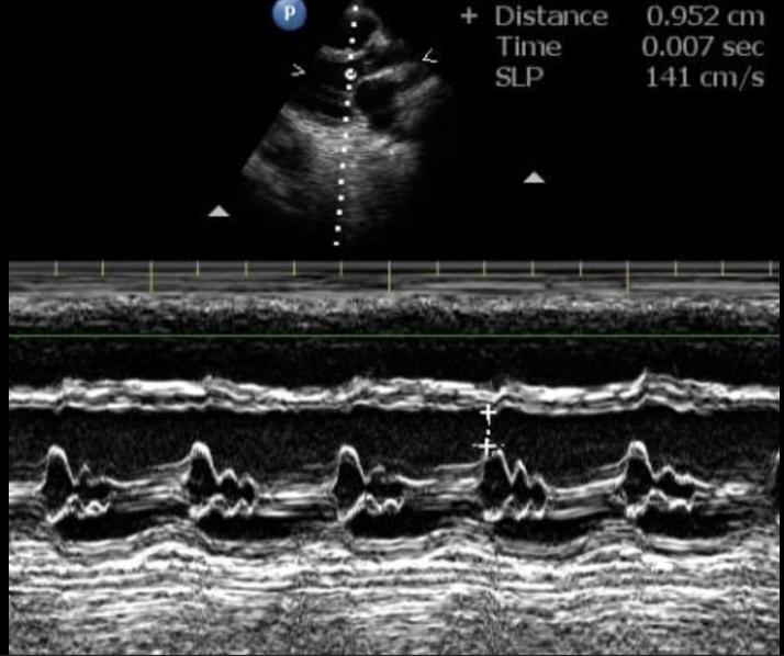 <p>records the motion of the heart over time. It is used to evaluate the structures of the heart throughout the cardiac cycle</p>