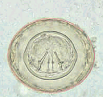 <p><span>Similar to</span><br><span>H. nana ova</span><br><span>4 58 x 86 um</span><br><span>4 has thick outer shell,</span><br><span>yellow</span><br><span>4 colorless inner shell</span><br><span>(onchosphere)</span><br><span>4 3 pairs of hooklets</span><br><span>present</span><br><span>4 no polar filaments</span><br><span>from inner membrane.</span><br><span>– Distinguishes it form</span><br><span>H.</span><br><span>nana</span></p>