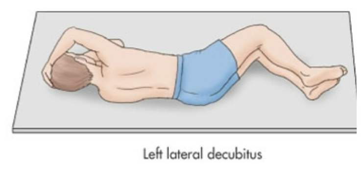 <ol><li><p>Laying directly on left side</p></li><li><p>90 degrees</p></li></ol>