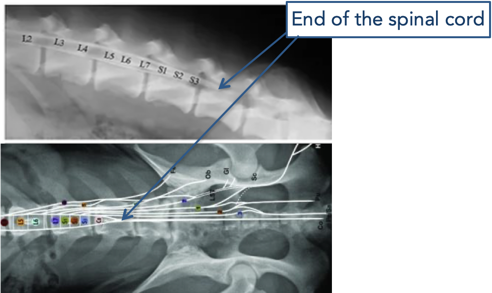 <p>As an embryo, the two grow at the same rate… but as the embryo develops, the neural tube slows down while the vertebral column continues, resulting in different lengths of the vertebrae and the spinal cord later into adulthood</p><ul><li><p>Because of this, the<strong>&nbsp;cauda equina</strong>&nbsp;is developed</p><ul><li><p>A group of dorsal and ventral roots of spinal nerves in the lumbo-sacral vertebral canal, stretch past the spinal cord to innervate the rest of the vertebrae&nbsp;</p></li><li><p>Looks like a horse tail</p></li></ul></li></ul><p></p>
