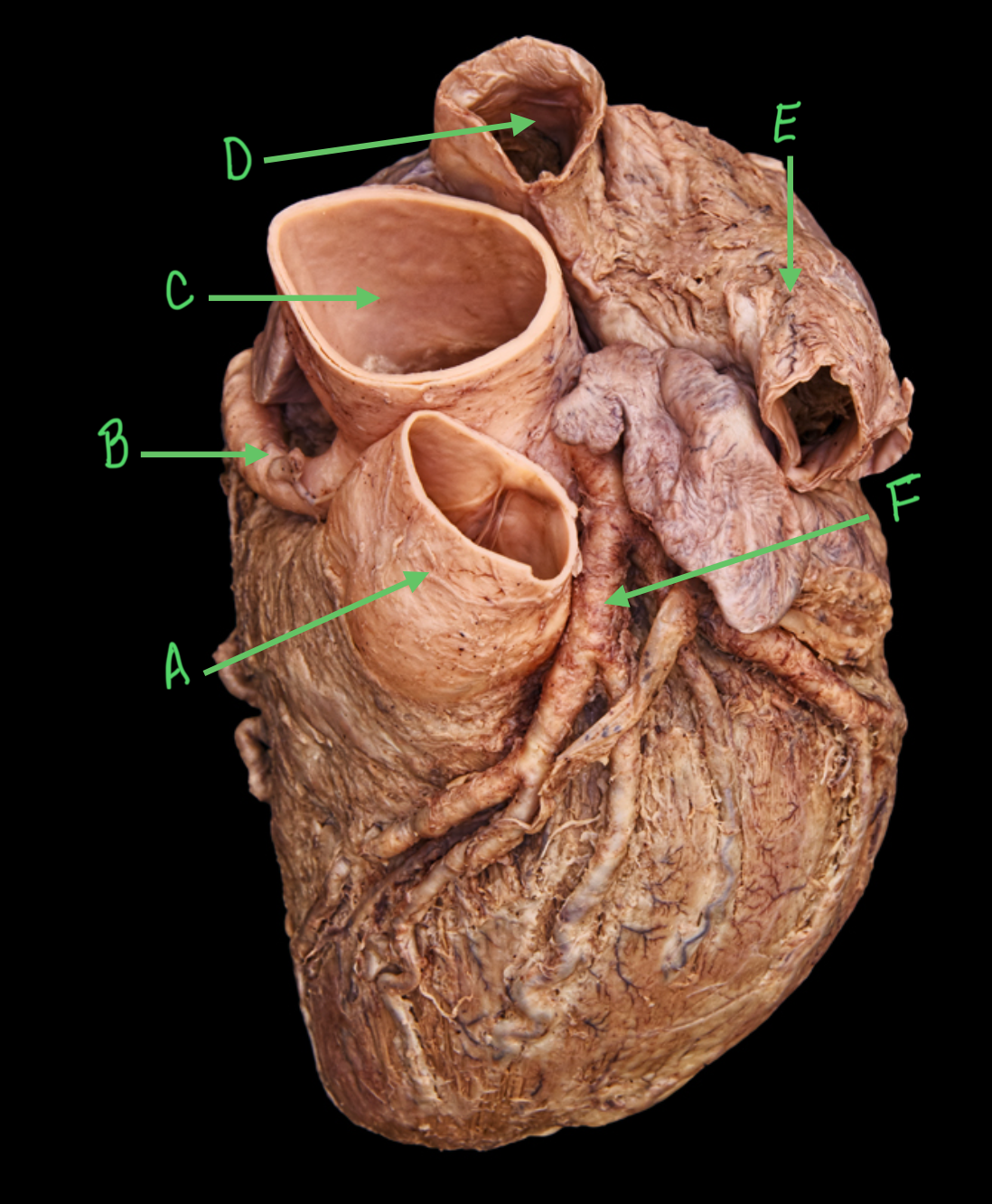 term image