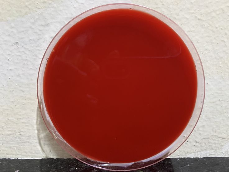 <p>Purpose of blood agar?</p>