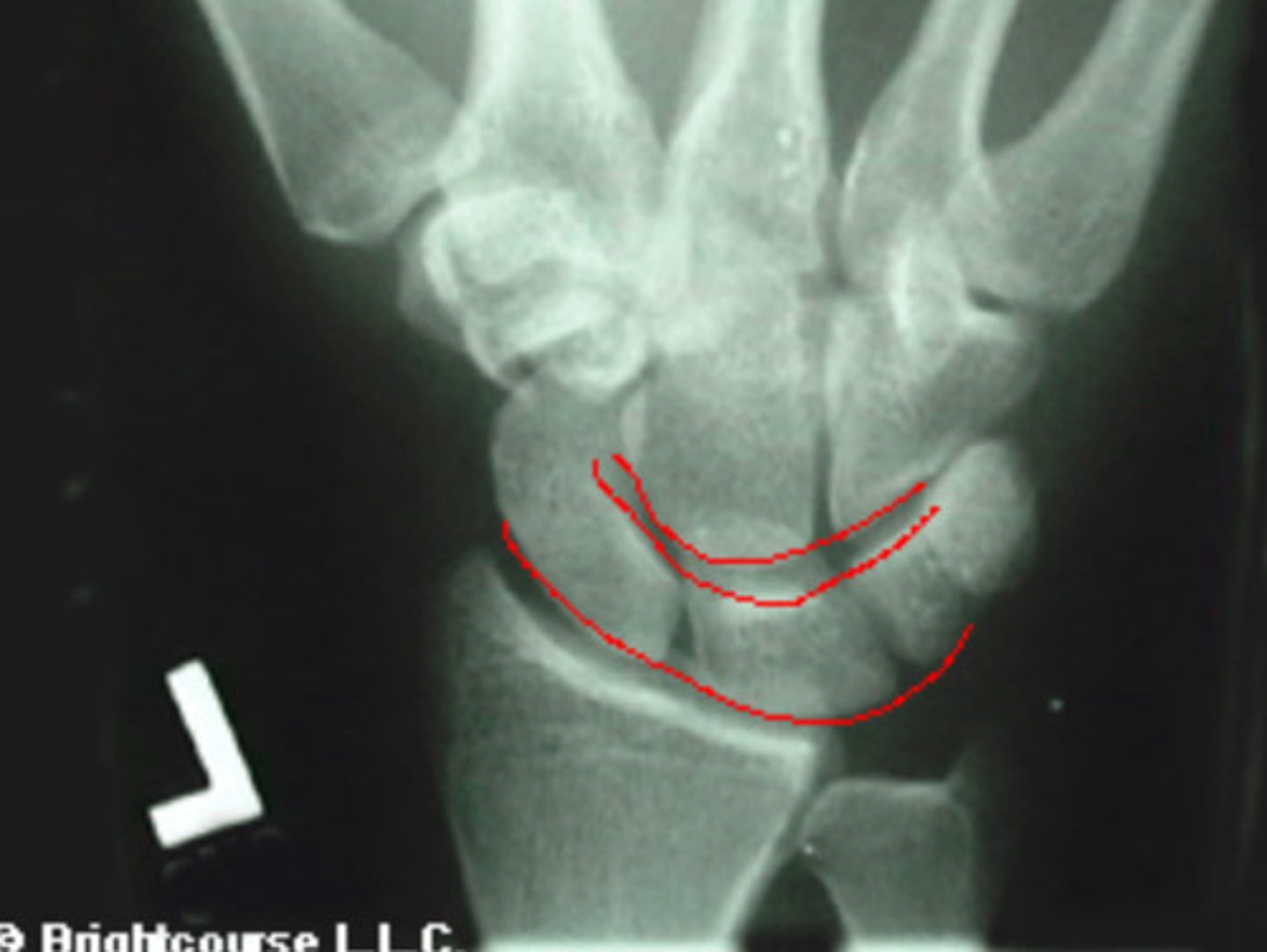 <p>What is being assessed in this image?</p>