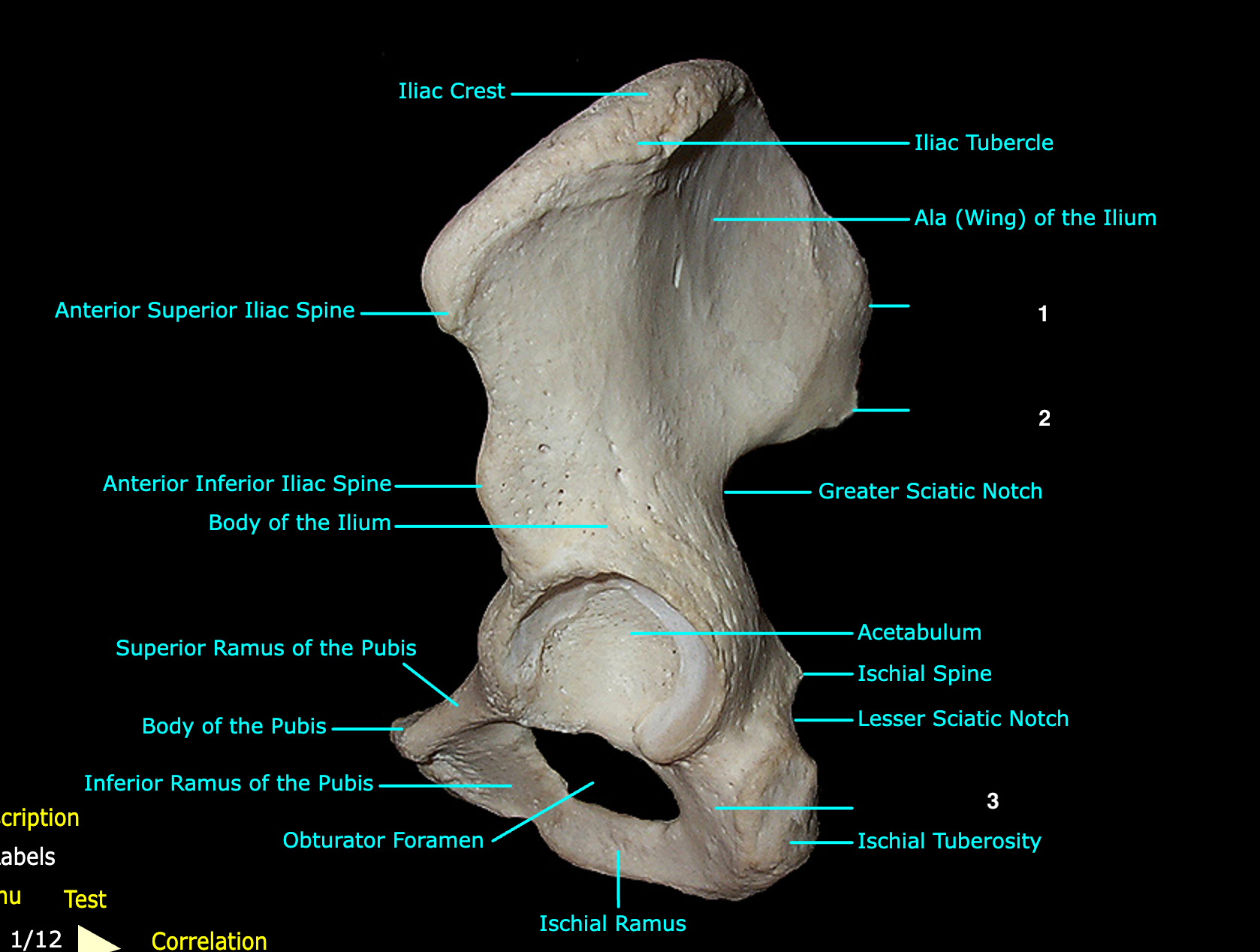 <p>What structure is labeled 3?</p>