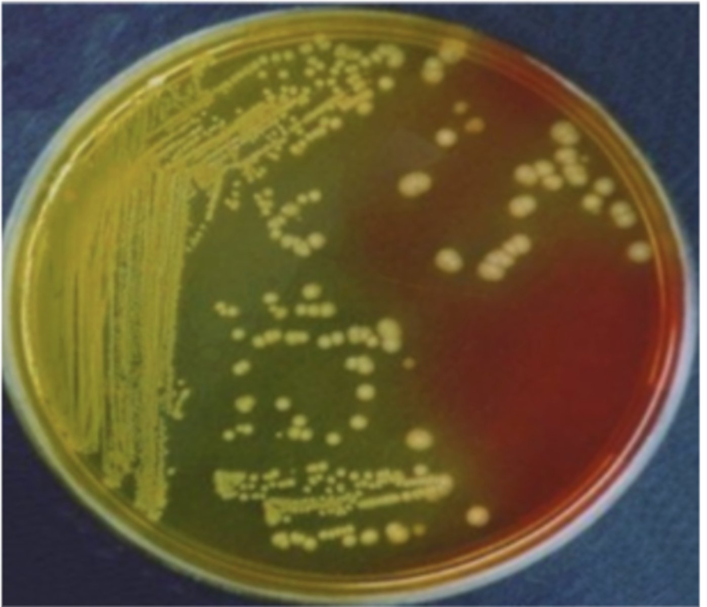 <p>on BC agar, which genus of the family Enterobacteriaceae produces these yellow colonies?</p>