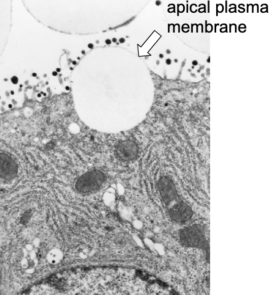 <p>what gland is this</p>