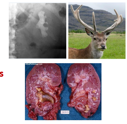 <p><span><span>also sometimes called coral calculi, obtain their characteristic</span></span><br><span><span>shape by forming a cast of the renal pelvis and calyces, thus</span></span><br><span><span>resembling the horns of a stag.</span></span></p>