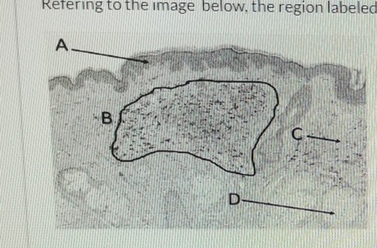 <p>photomicrograph</p>