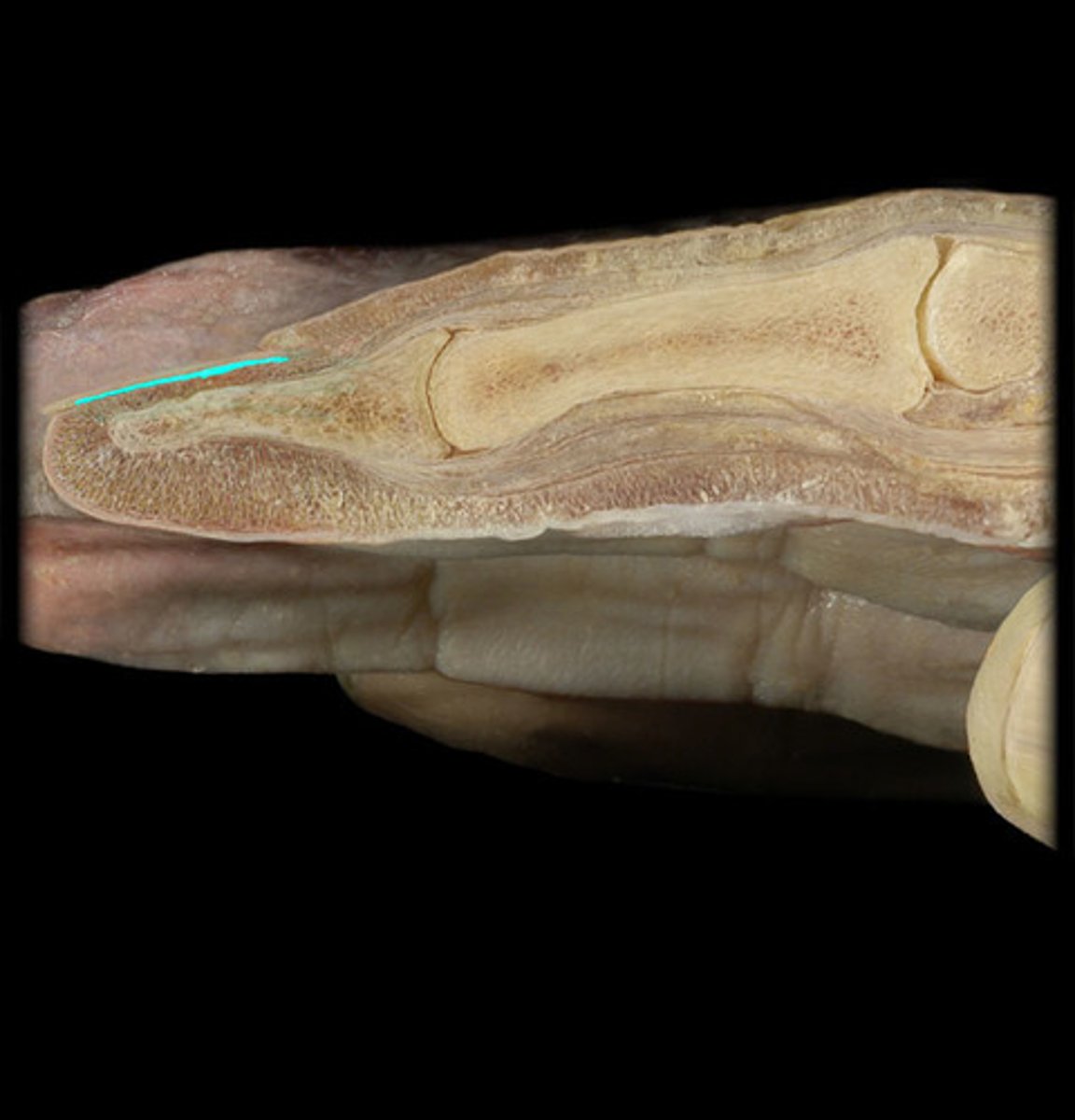 <p>- Skin beneath the nail body, supplying it with nutrients.</p>