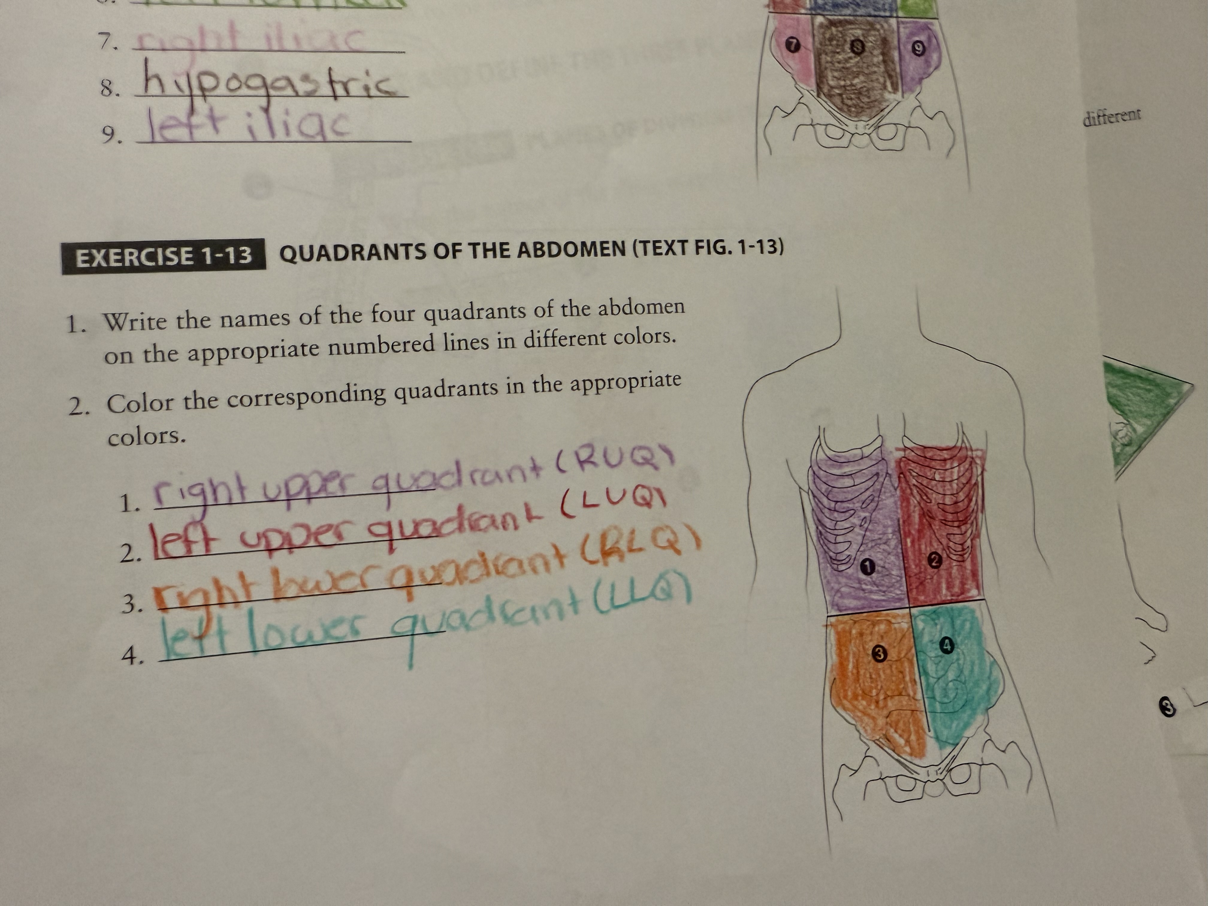<p>Term 1</p>