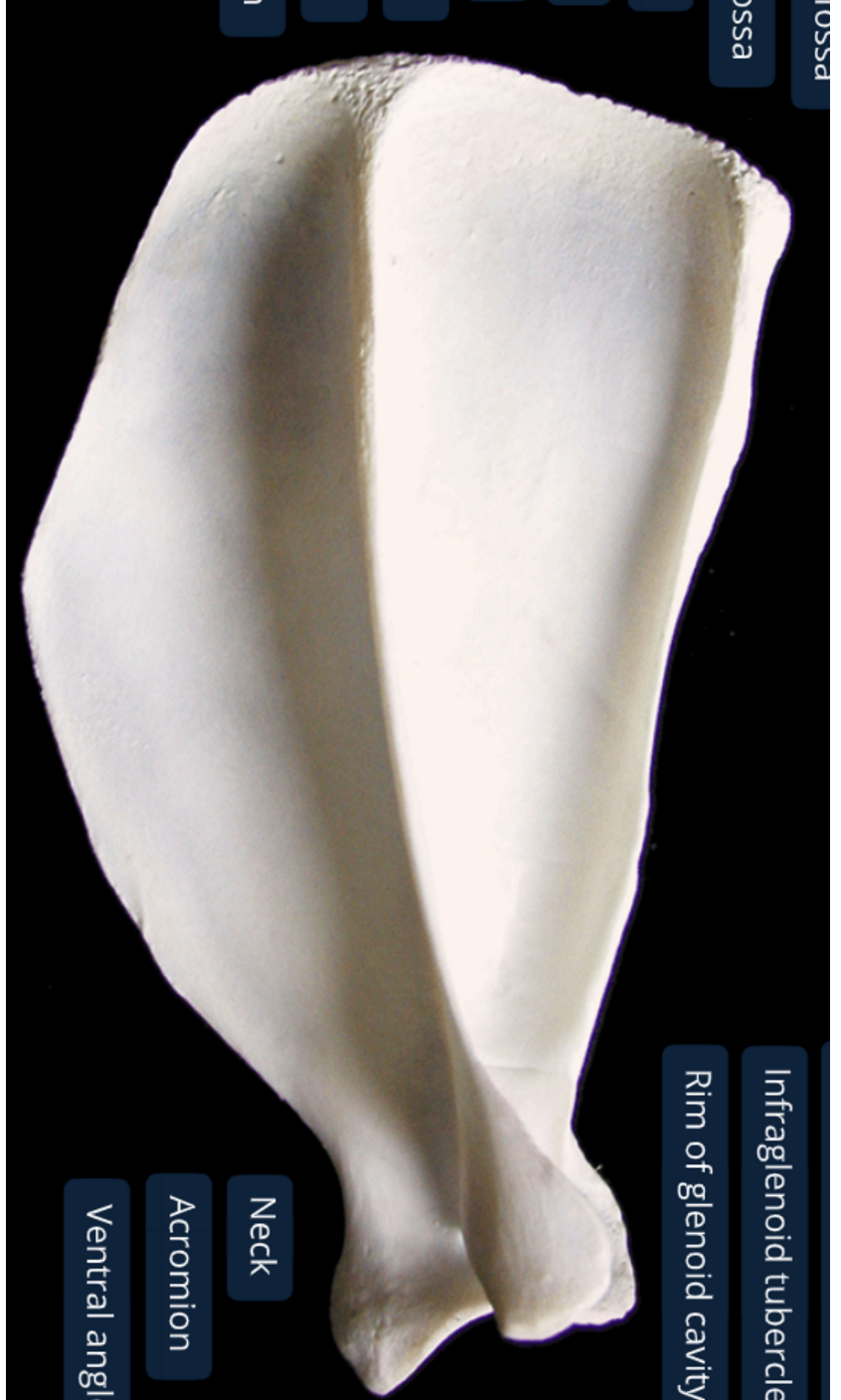 <ol><li><p>supraspinous fossa: supraspinatus m originates here </p></li><li><p>infraspinous fossa: infraspinatus m originates here</p></li><li><p>acromion: distal end of spine</p></li><li><p>spine: divides lateral surf into 2 equally sized fossa</p></li><li><p>supraglenoid tubercle: cranial prominence at ventral angle </p></li></ol><p></p>