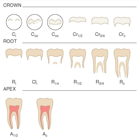 <p><strong><span style="font-family: Times New Roman, serif">A tooth aging method based on development. Established in 1963, comprised of 14 developmental stages (crown, root, apex), MFH was discovered using x-rays at 6-month intervals. This is an OUTDATED method. The Smith MFH (most updated version)</span></strong></p>