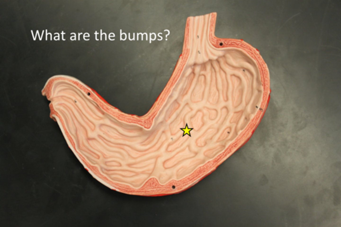 <p>Accordion-like folds in the stomach that allow it to stretch.</p>