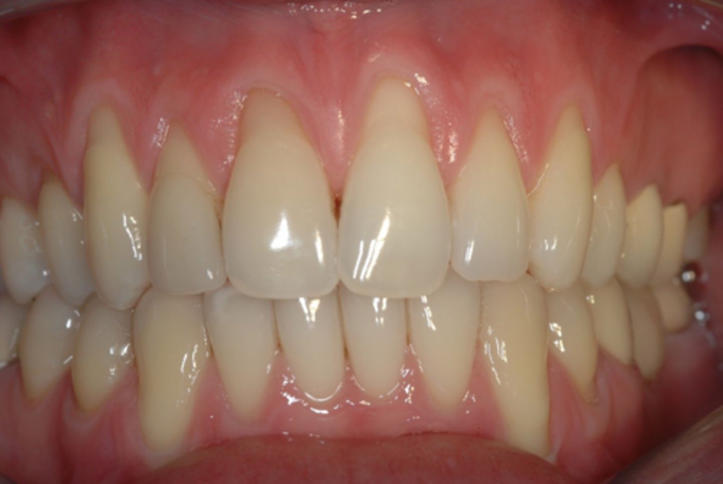 <p>What is the tissue biotype?</p>