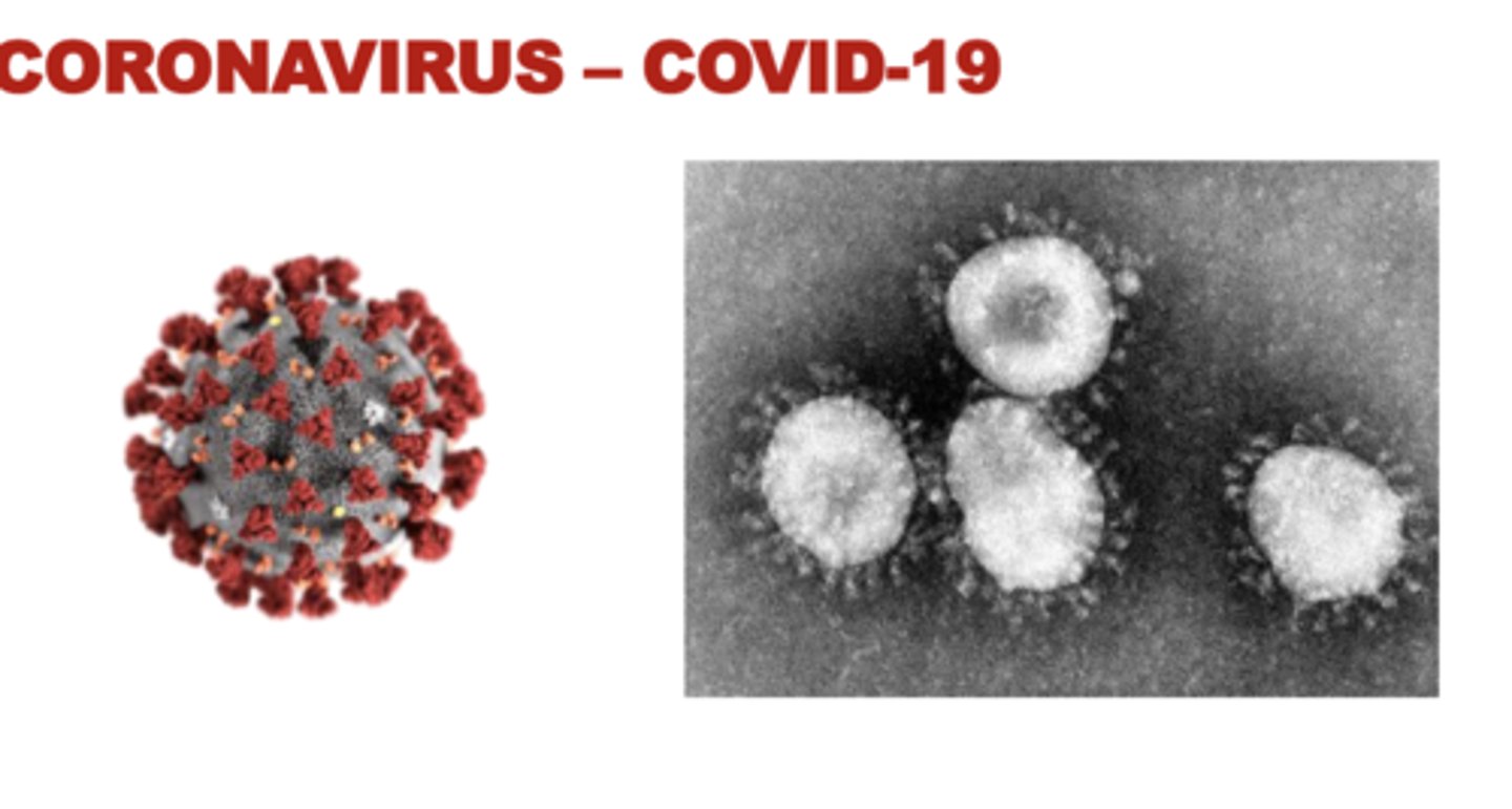 <p>respiratory disease caused by sars cov 2, spread through air or droplets</p><p>vaccine given if 6 months or older</p>