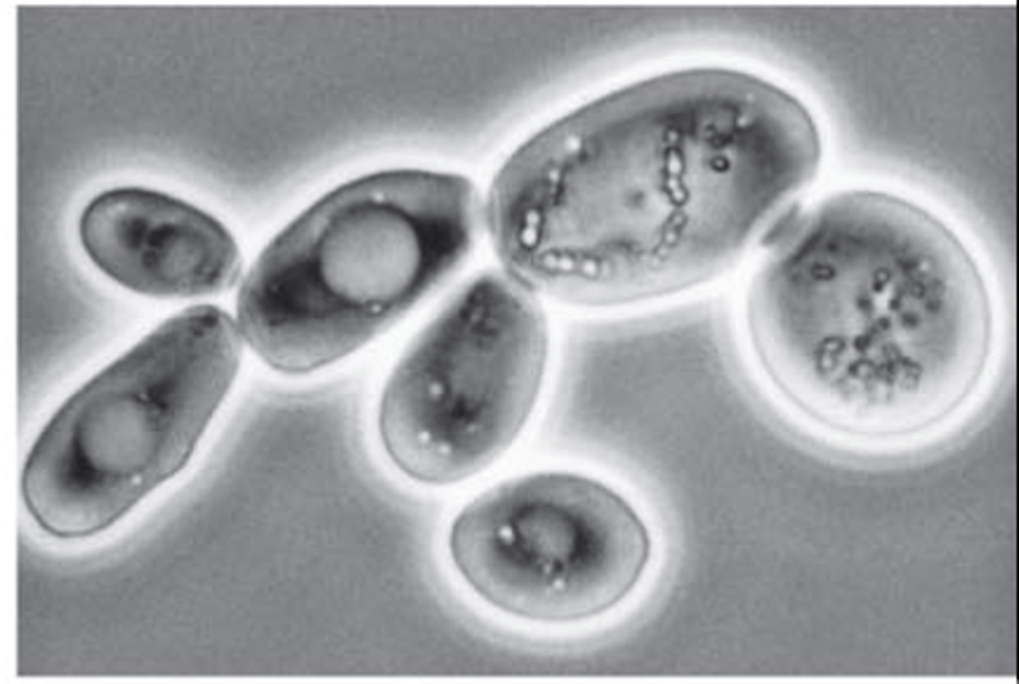 <p>Phase-contrast microscopy</p>