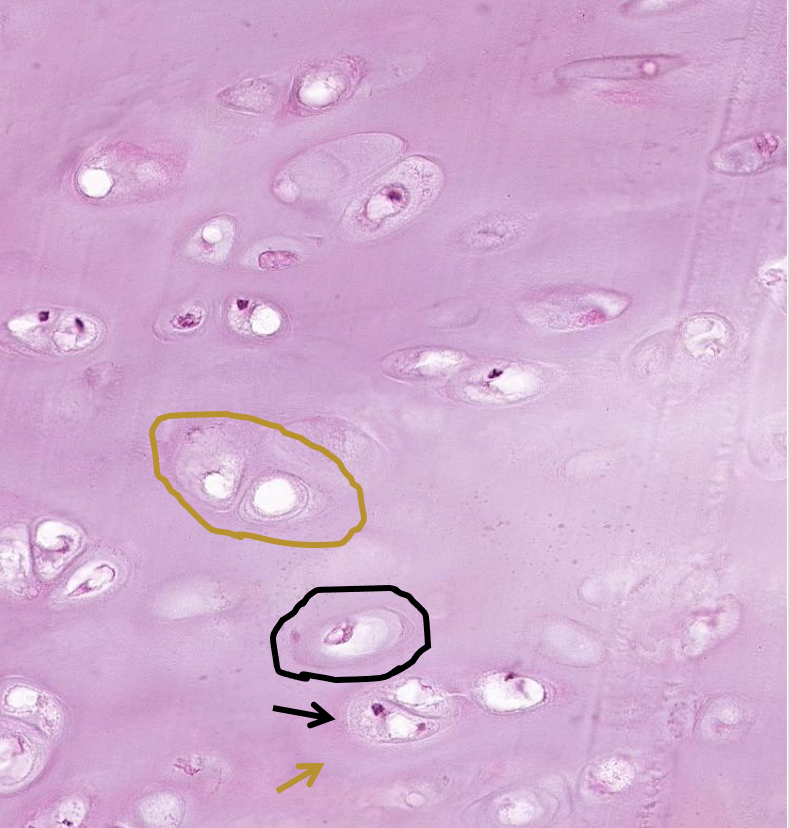 <p>ID what is in the brown &amp; black circle. What types of matrix are found at the brown &amp; black arrows?</p>