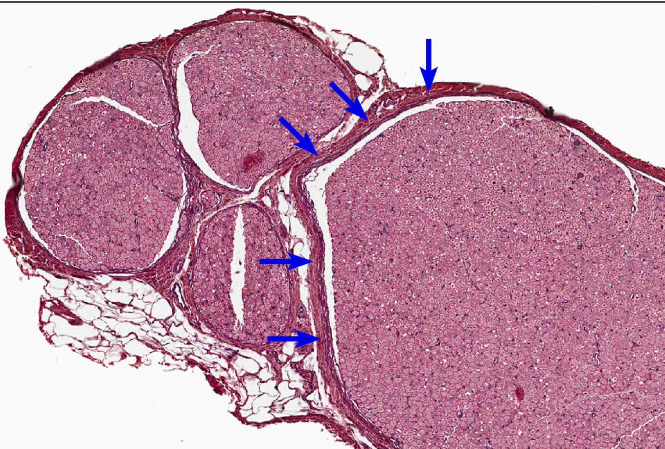 <p><span style="color: rgb(38, 38, 38)">The _______ consists of a dense irregular connective tissue of collagen bundles that blends with the surrounding connective tissue. Epineurium surrounds larger trunks of peripheral nerves and is lost as peripheral nerves decrease in size.</span></p>