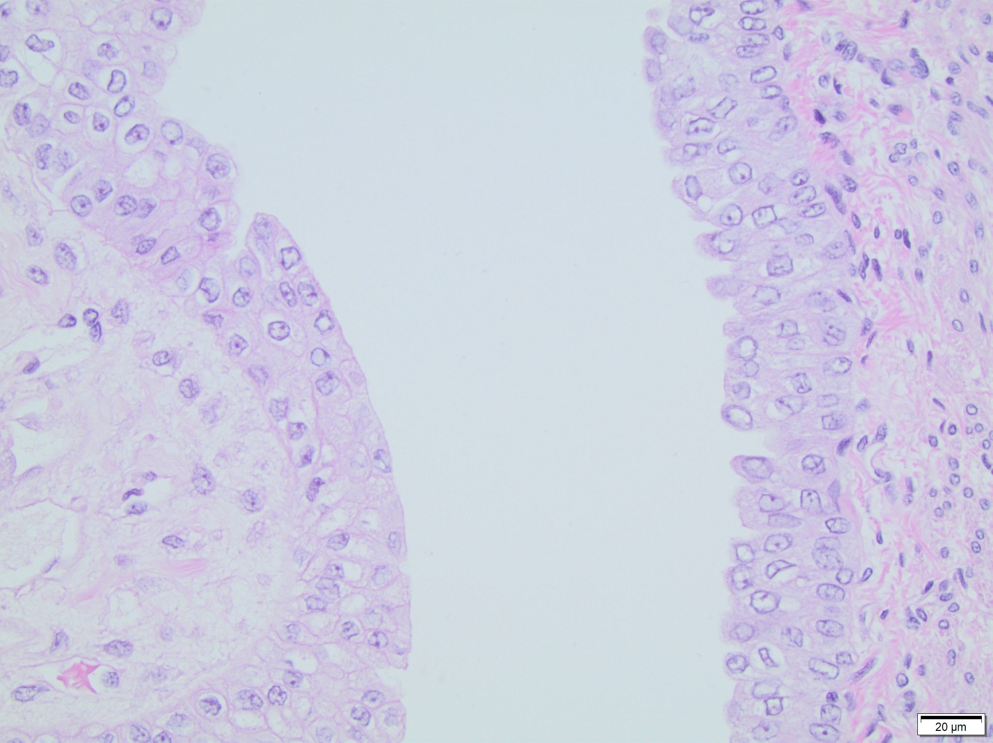 <p>specialized epithelial lining that covers the urinary tract (bladder, ureters, and renal pelvis)</p>